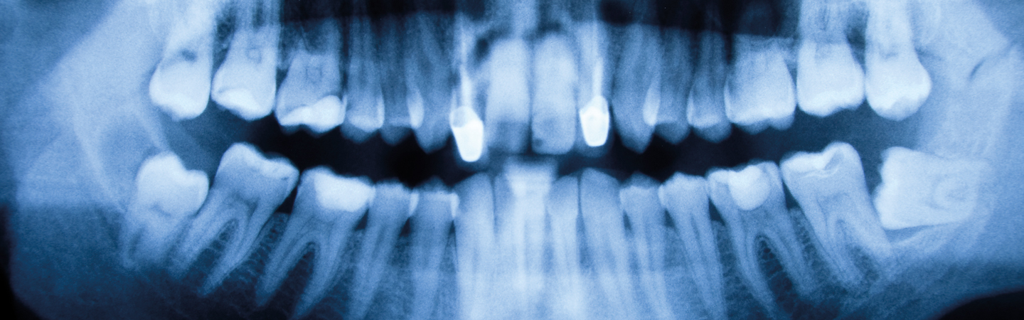 Radiography For Dental Nurses And DCPs (Course 5): IRMER, Quality ...